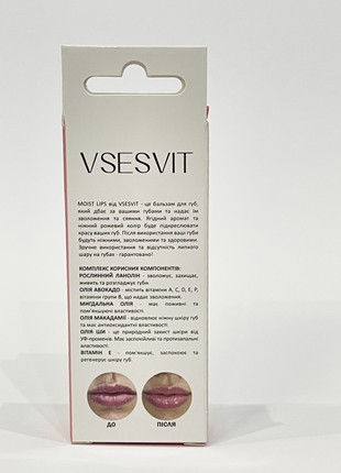 Lip balm MOIST LIPS from VSESVIT2 photo